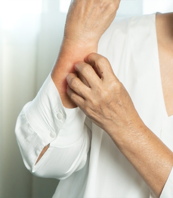 A patient scratching his arm with psoriasis