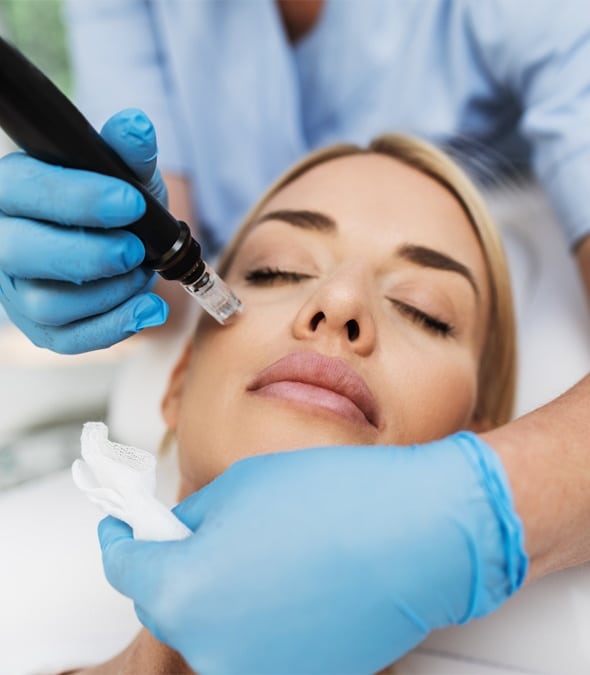 A dermatologist microneedling a woman's face